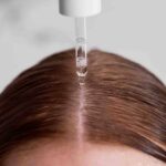 تونیک برطرف کننده خشکی کف سر - Image 2