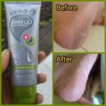 کرم ترمیم کننده پا فیت اپ - Image 2